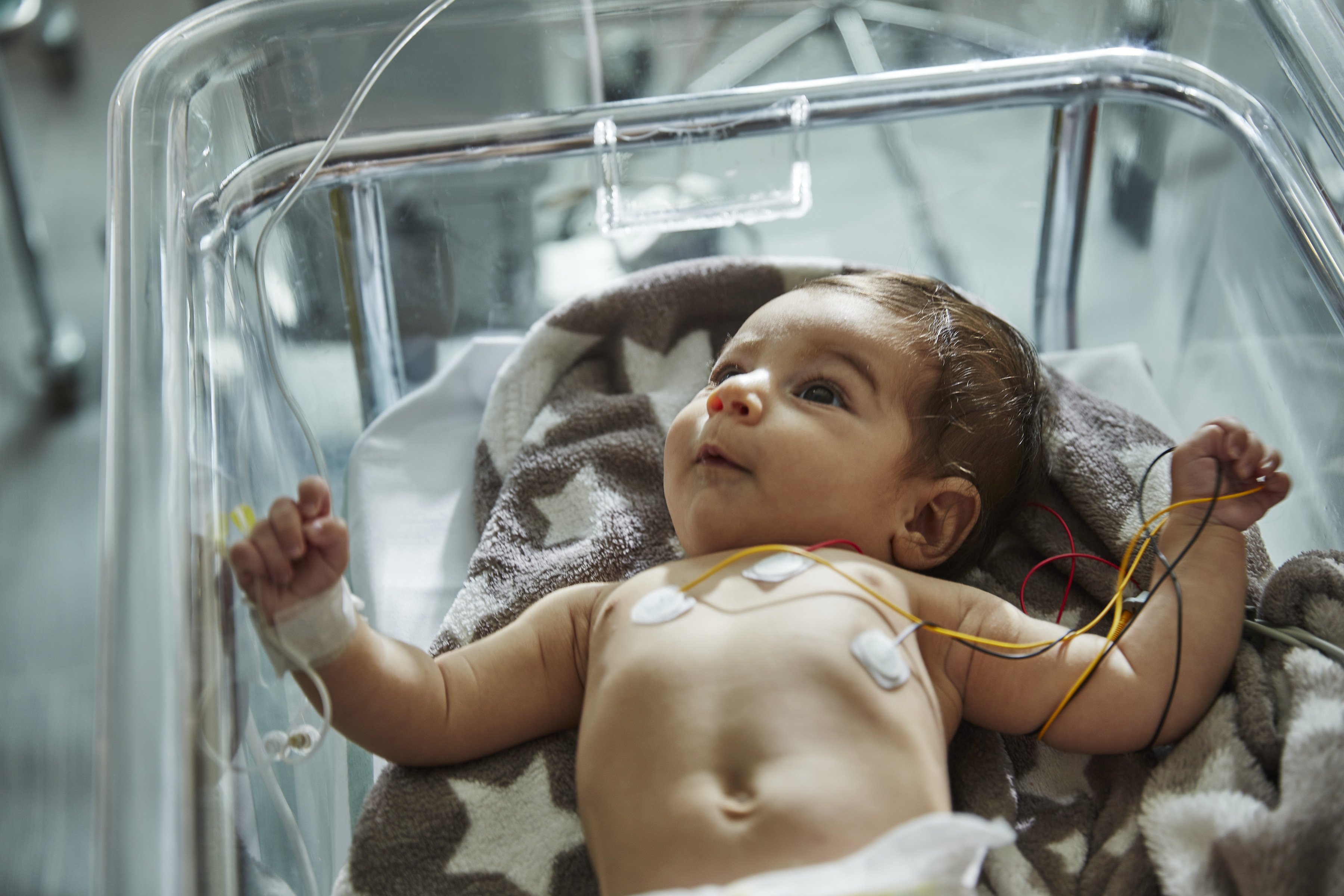 A baby lies in a hospital cot, looking up. Electrodes and medical wires are attached to the baby's chest and hand. The baby is covered with a patterned blanket, indicating a hospital or medical setting.